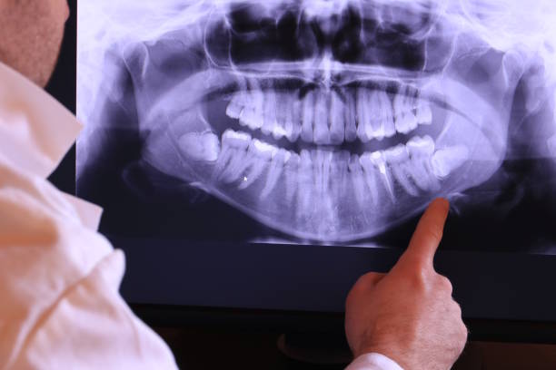 Best Urgent Tooth Repair  in Lake Dallas, TX