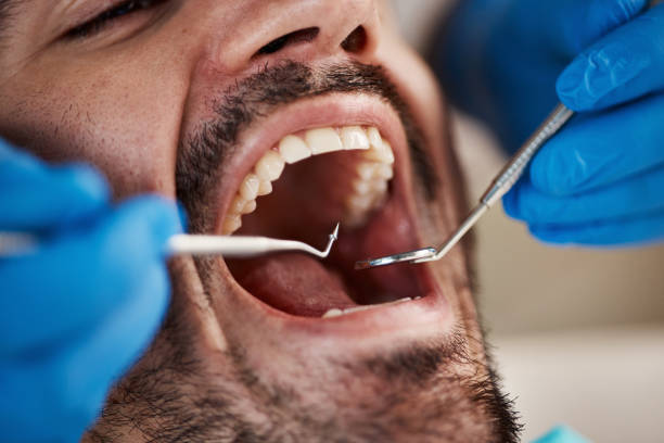 Best Dentist for Dental Trauma  in Lake Dallas, TX
