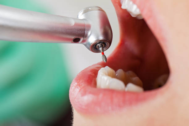 Best Urgent Tooth Repair  in Lake Dallas, TX